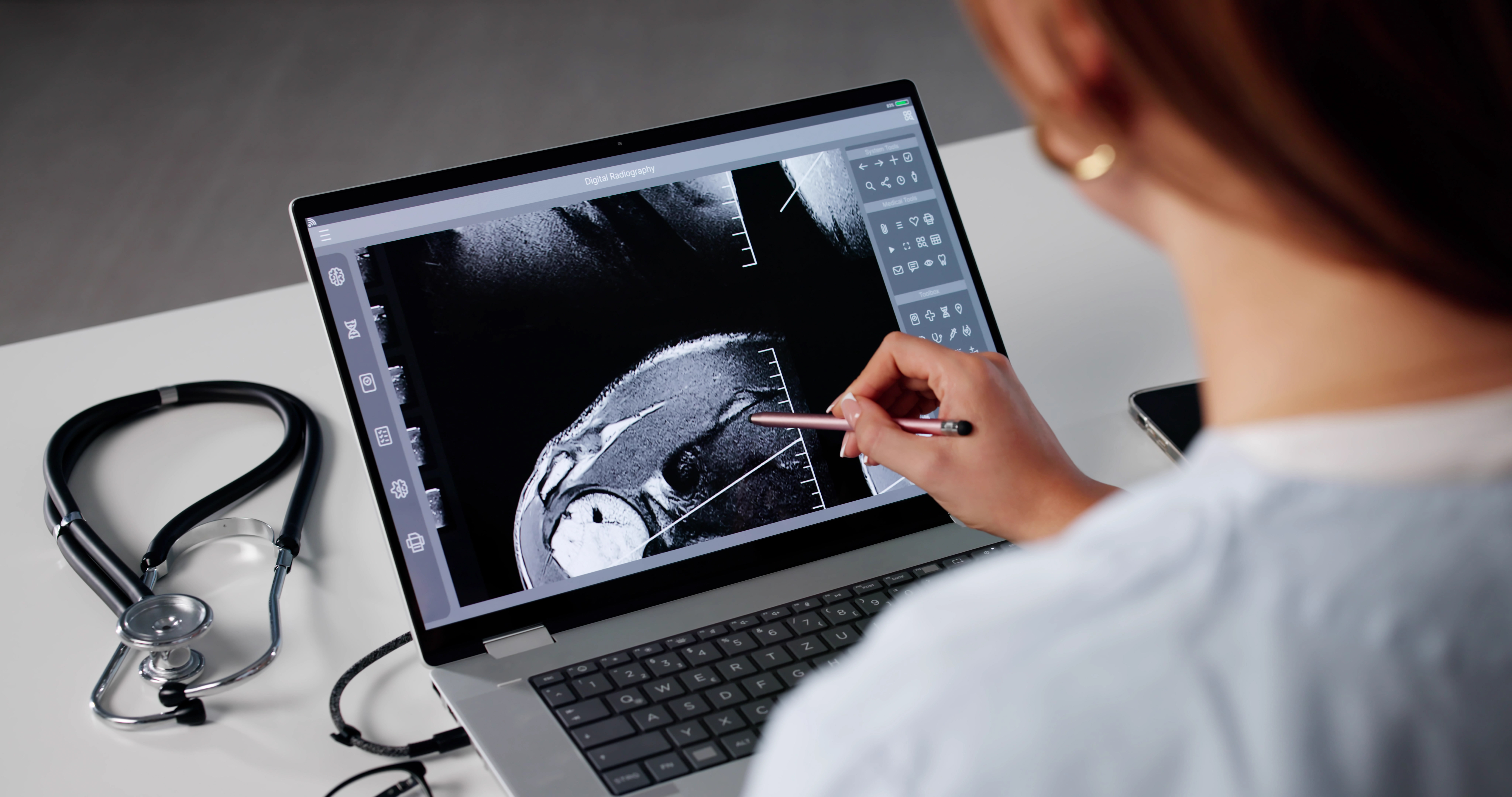 Orthopedic Surgeon Reviews MRI On Computer.